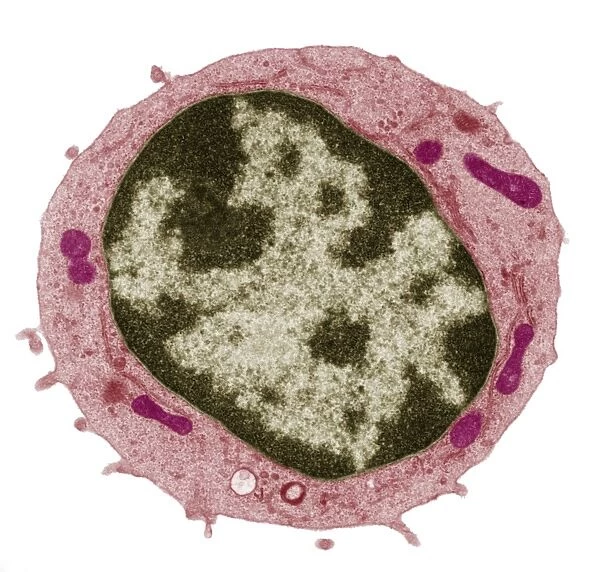Small lymphocyte, TEM