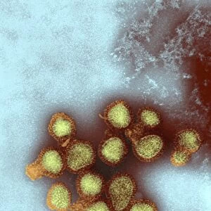 H5N3 influenza A virus particles, TEM